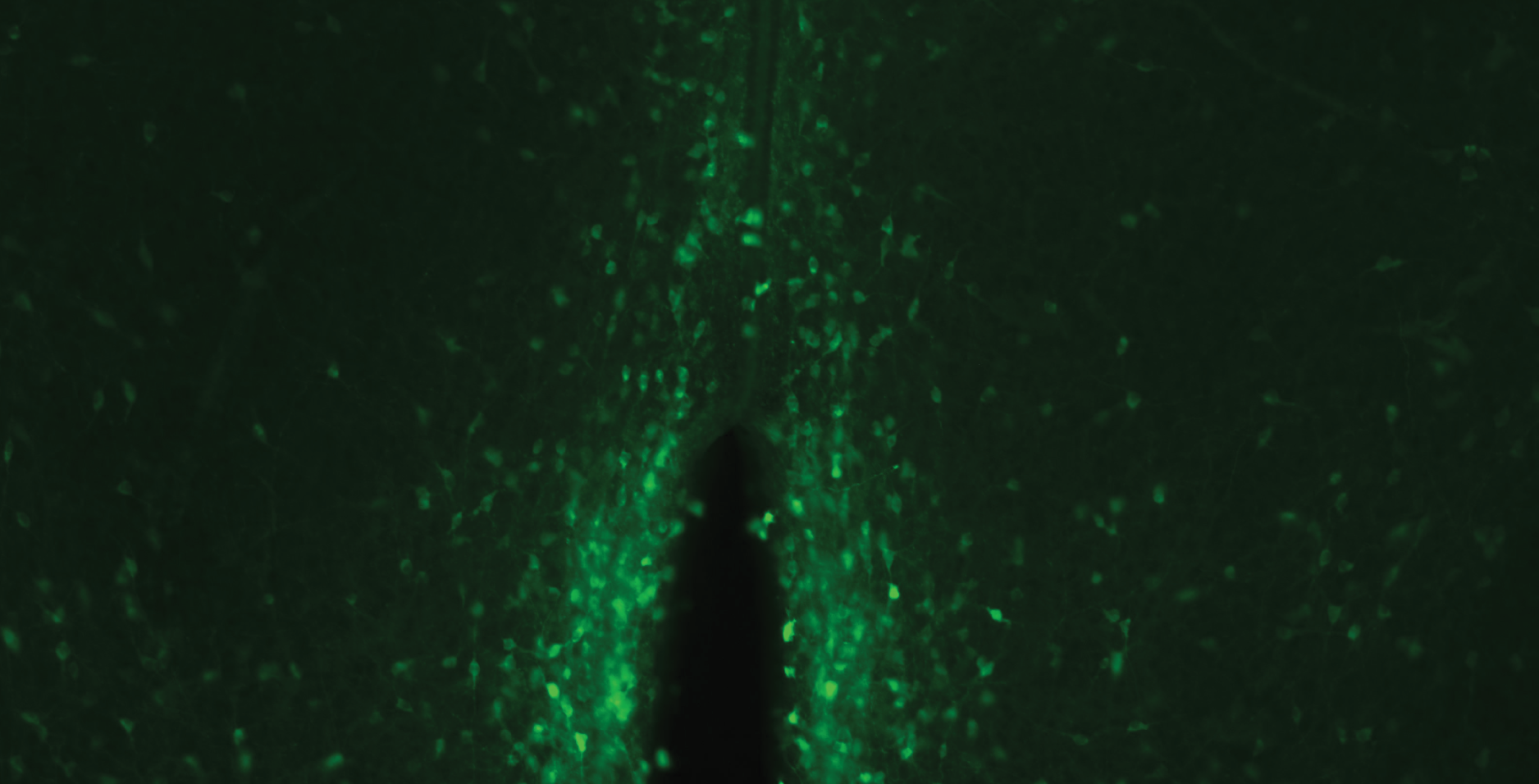 GCaMP calcium imaging
